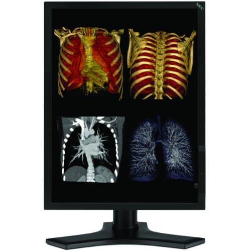 NEC MD213MC 21.3" 2048 x 1536 Monitor
