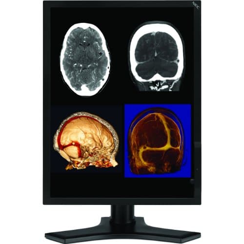 NEC MD212MC 21.3" 1600 x 1200 Monitor